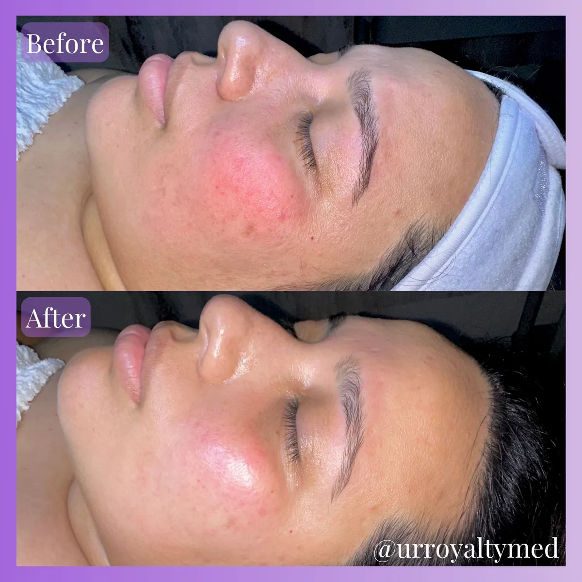 KALON MedSpa